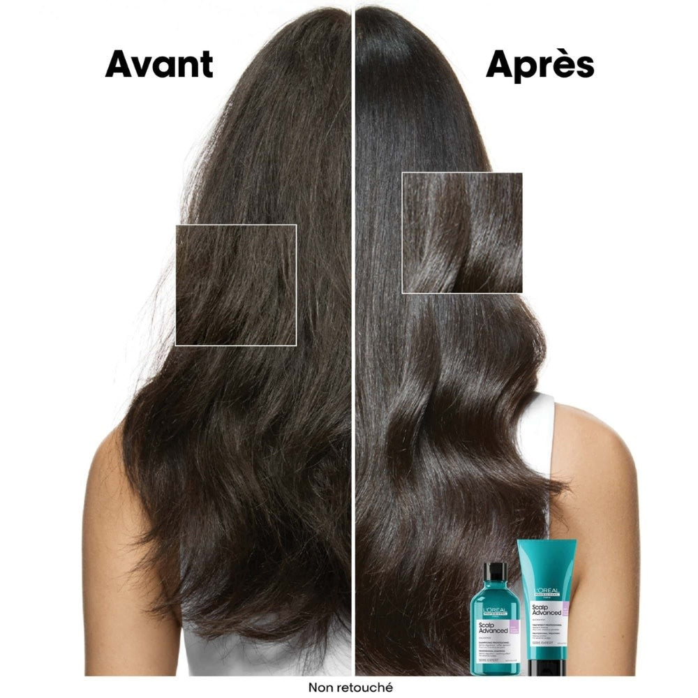 Shampoing anti-inconfort "Scalp Advanced"
