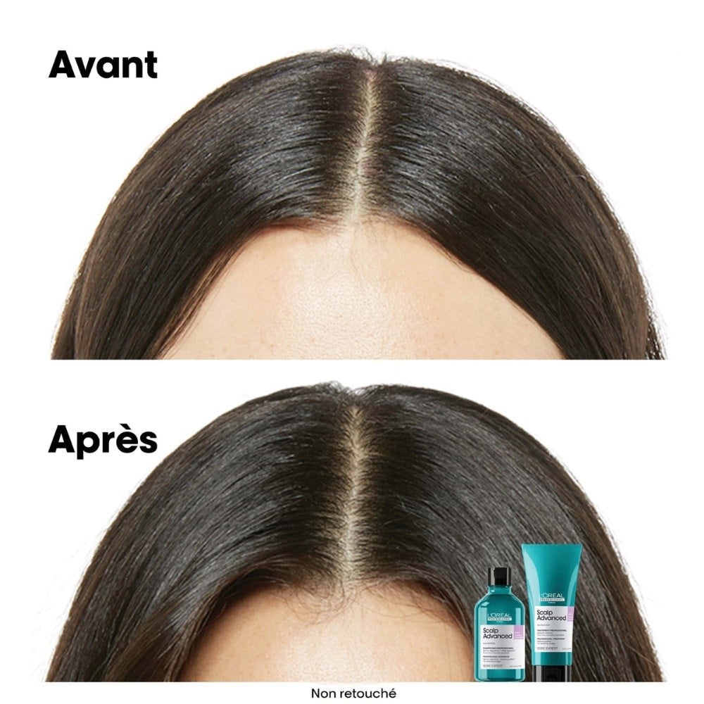 Shampoing anti-inconfort "Scalp Advanced"