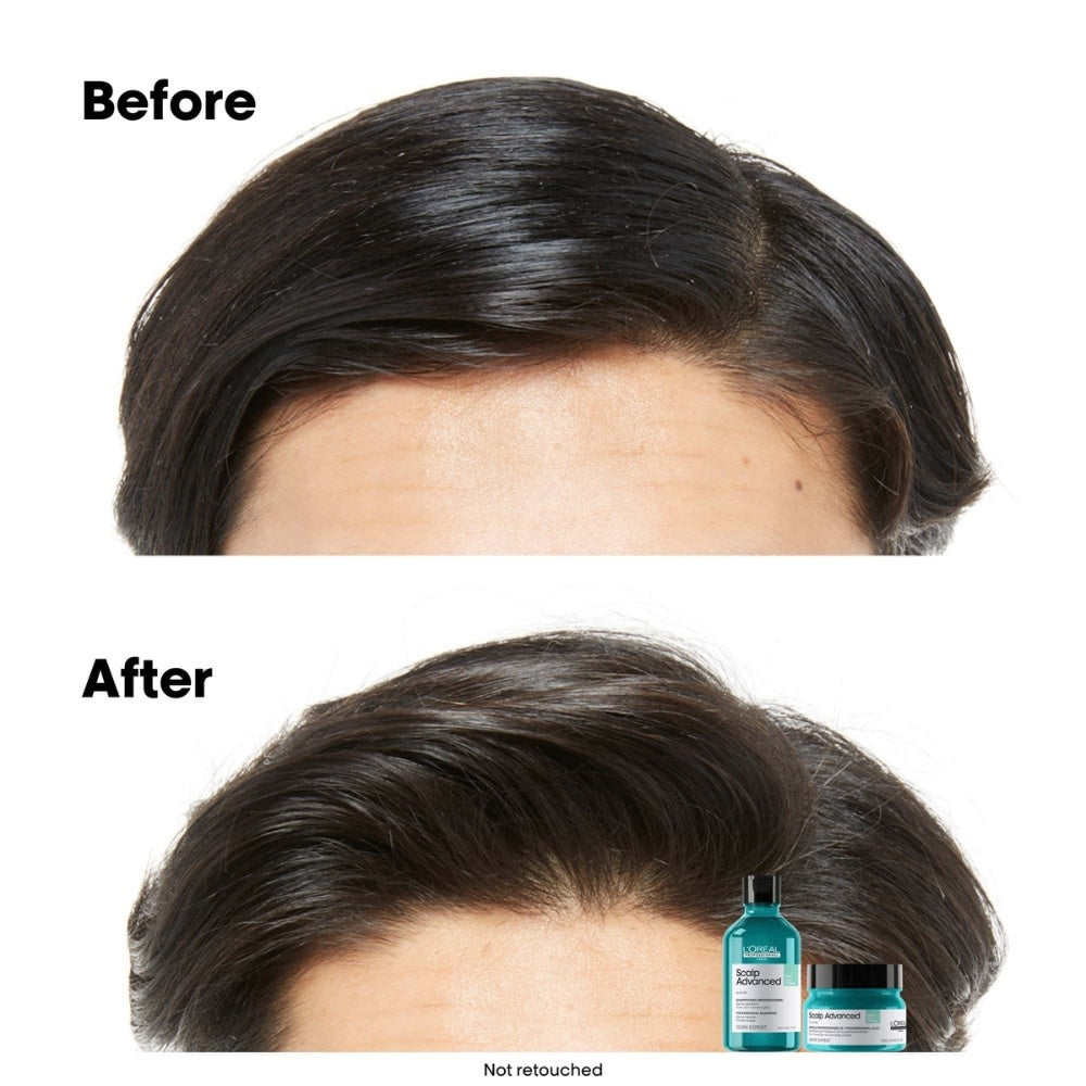 L'Oréal Professionnel - Shampoing dermo-purifiant anti-gras "Serie Expert Scalp Advanced Anti-Oilness" - Pour cuir chevelu gras