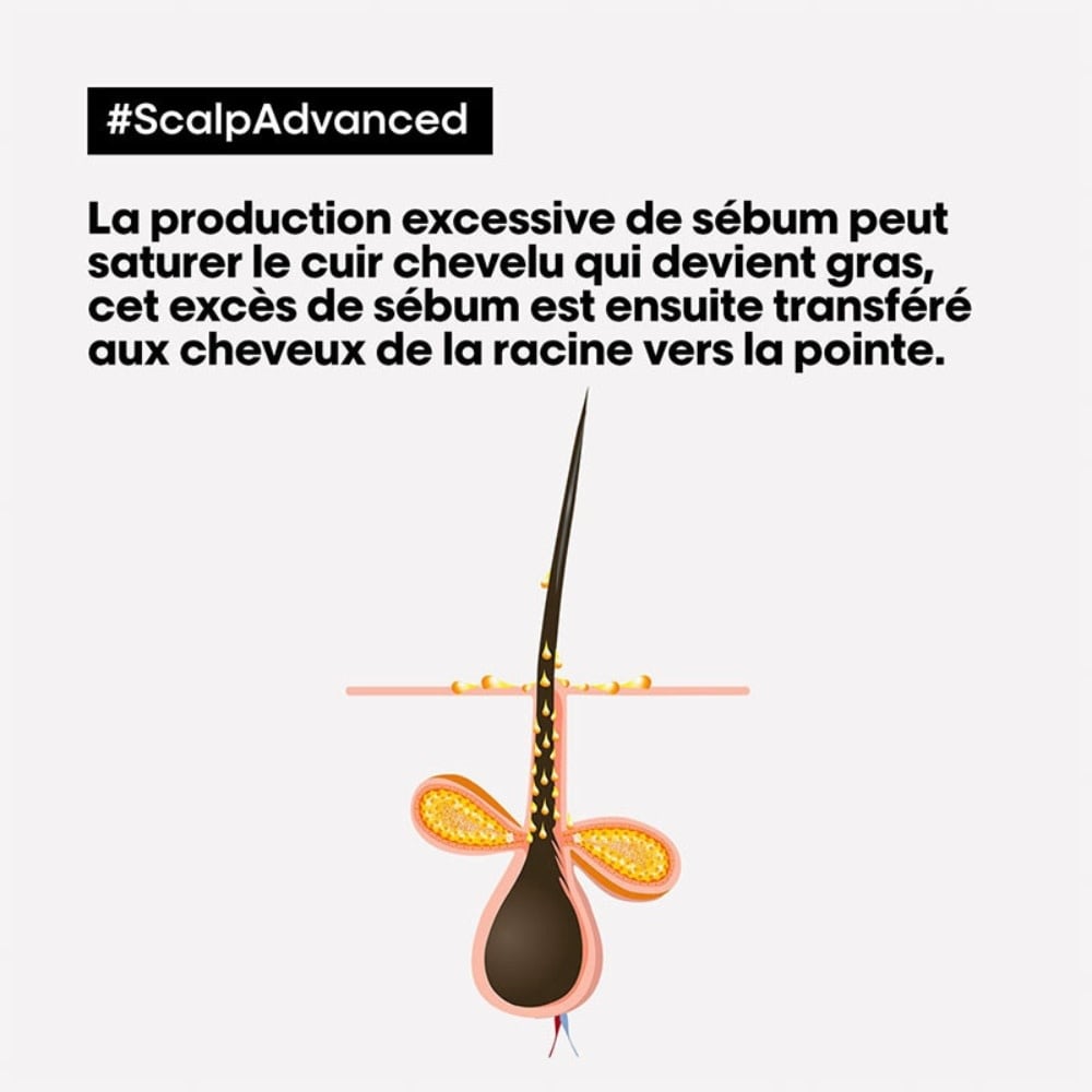 L'Oréal Professionnel - Shampoing dermo-purifiant anti-gras "Serie Expert Scalp Advanced Anti-Oilness" - Pour cuir chevelu gras