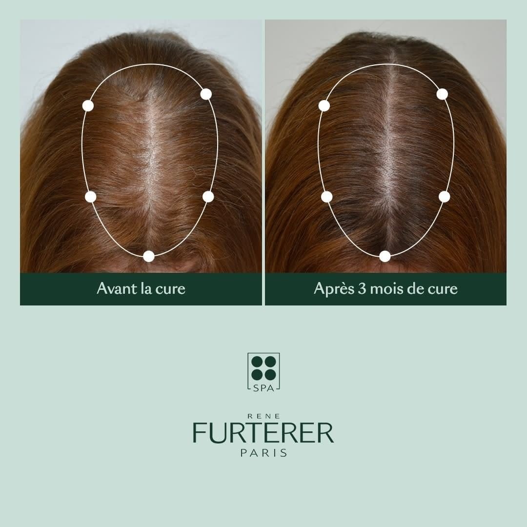 René Furterer - Shampoing épaississant "Triphasic" freine la perte de densité - Favorise la croissance des cheveux