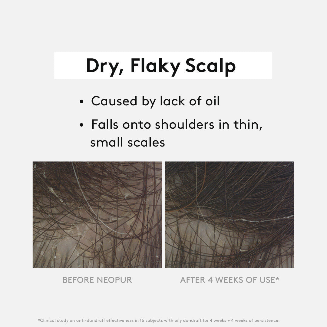 Shampoing antipelliculaire "Neopur" pellicules sèches
