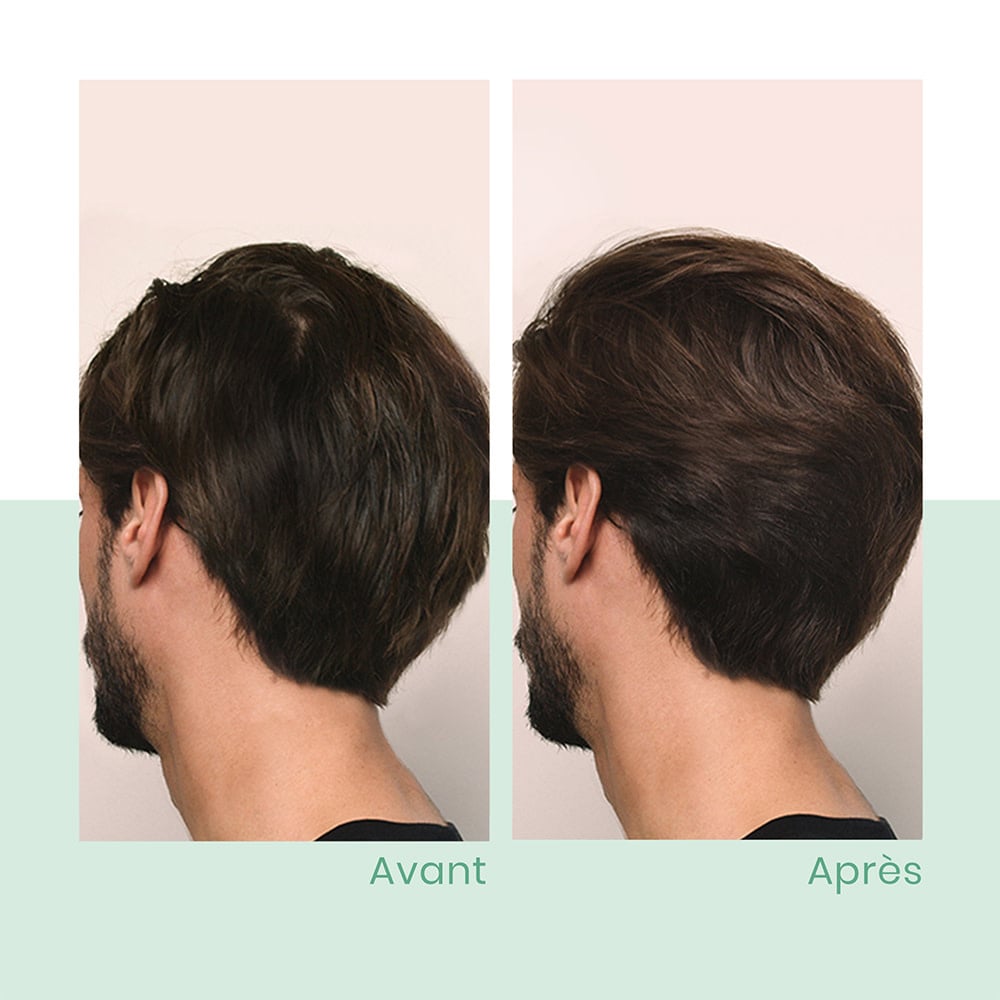 René Furterer - Shampoing épaississant "Triphasic" freine la perte de densité - Favorise la croissance des cheveux