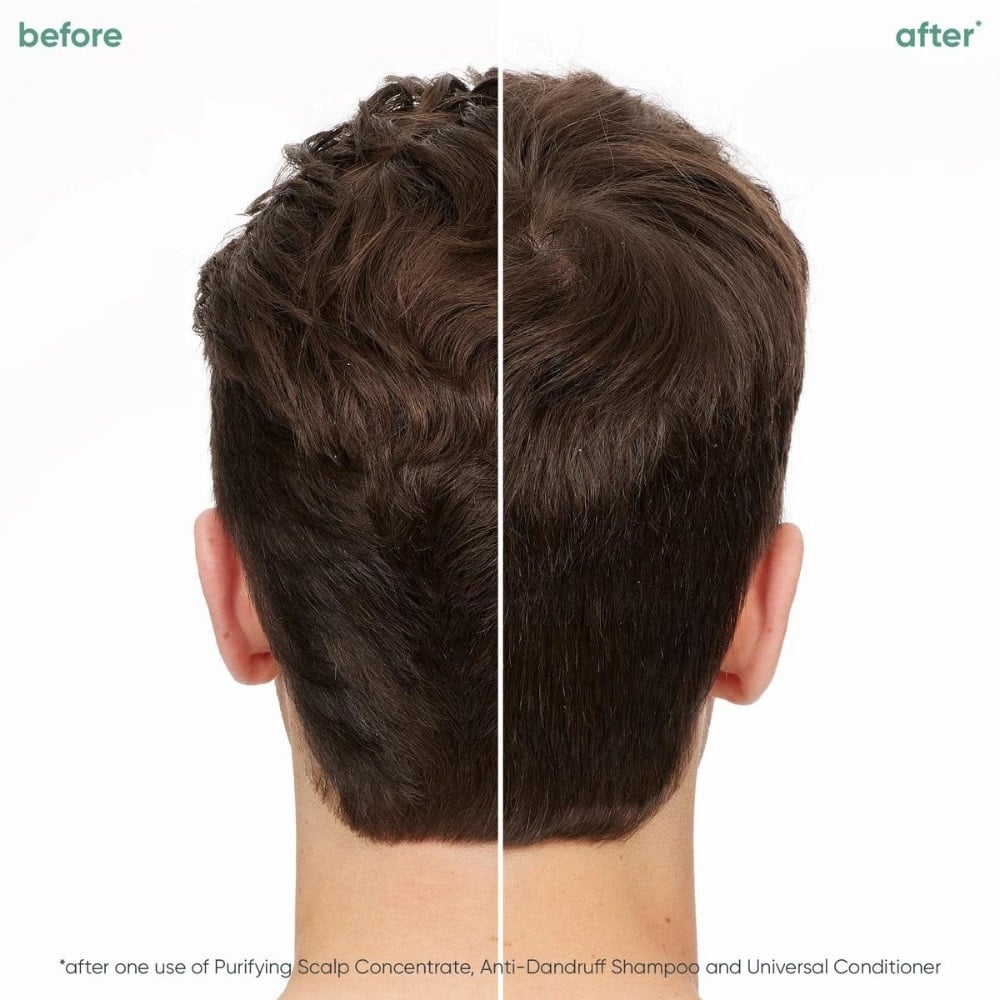 Shampoing antipelliculaire "Scalp Sync" - Pour le contrôle des pellicules