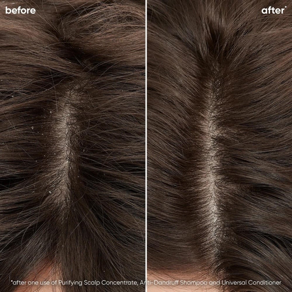 Shampoing antipelliculaire "Scalp Sync" - Pour le contrôle des pellicules