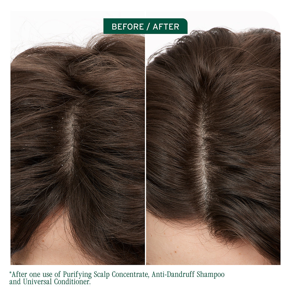 Shampoing antipelliculaire "Scalp Sync" pyrithione de zinc (400ml/13.5oz)