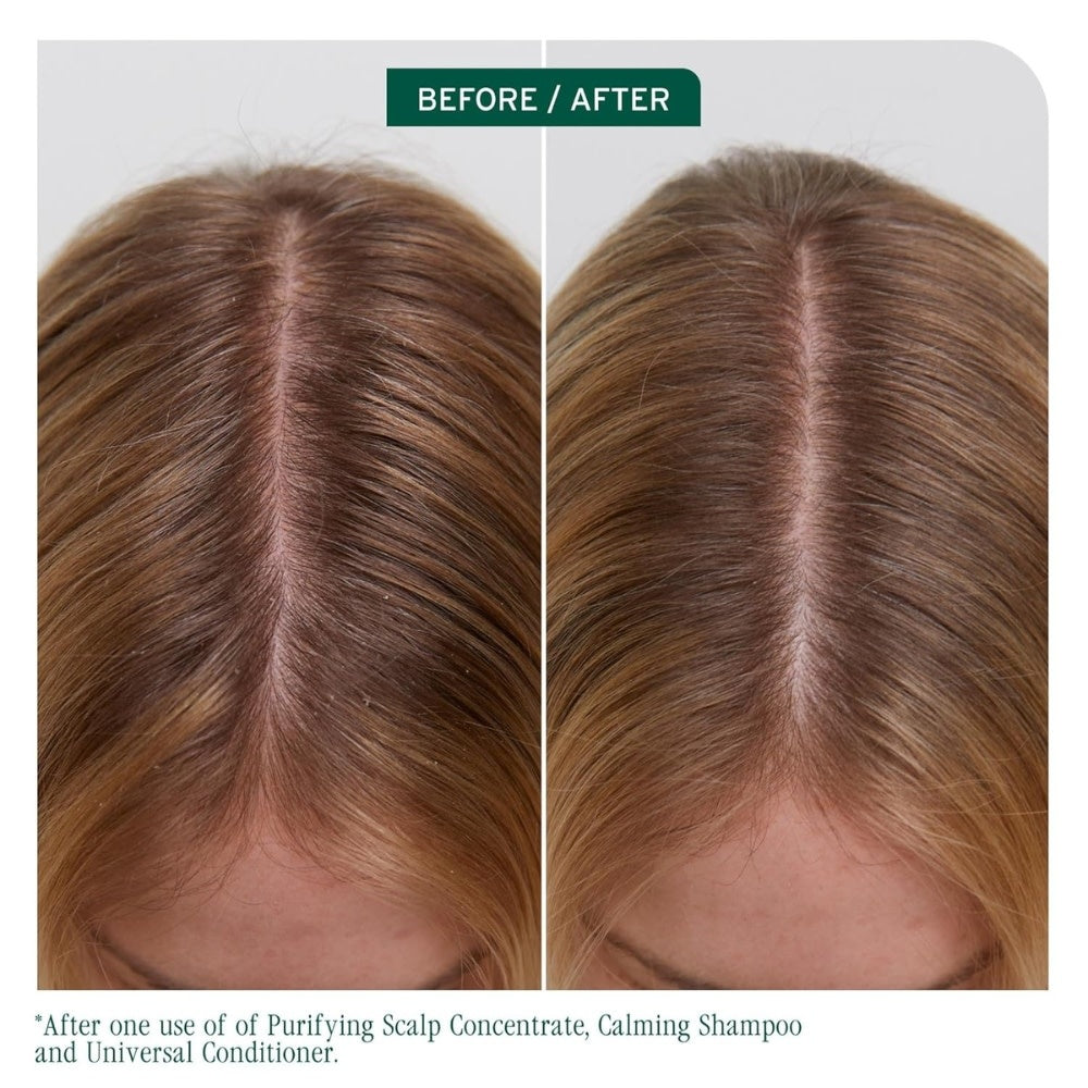 Shampoing calmant apaisant "Scalp Sync"