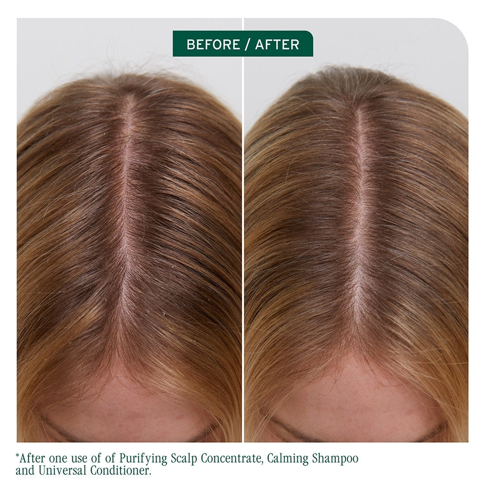 Concentré purifiant pour cuir chevelu "Scalp Sync" (200ml/6.8oz)